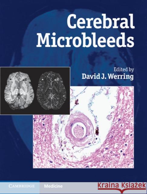 Cerebral Microbleeds: Pathophysiology to Clinical Practice Werring, David J. 9780521198455  - książka