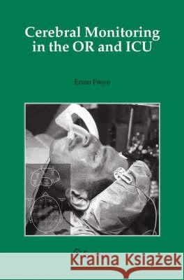 Cerebral Monitoring in the or and ICU Freye, Enno 9781402031625 Springer London - książka