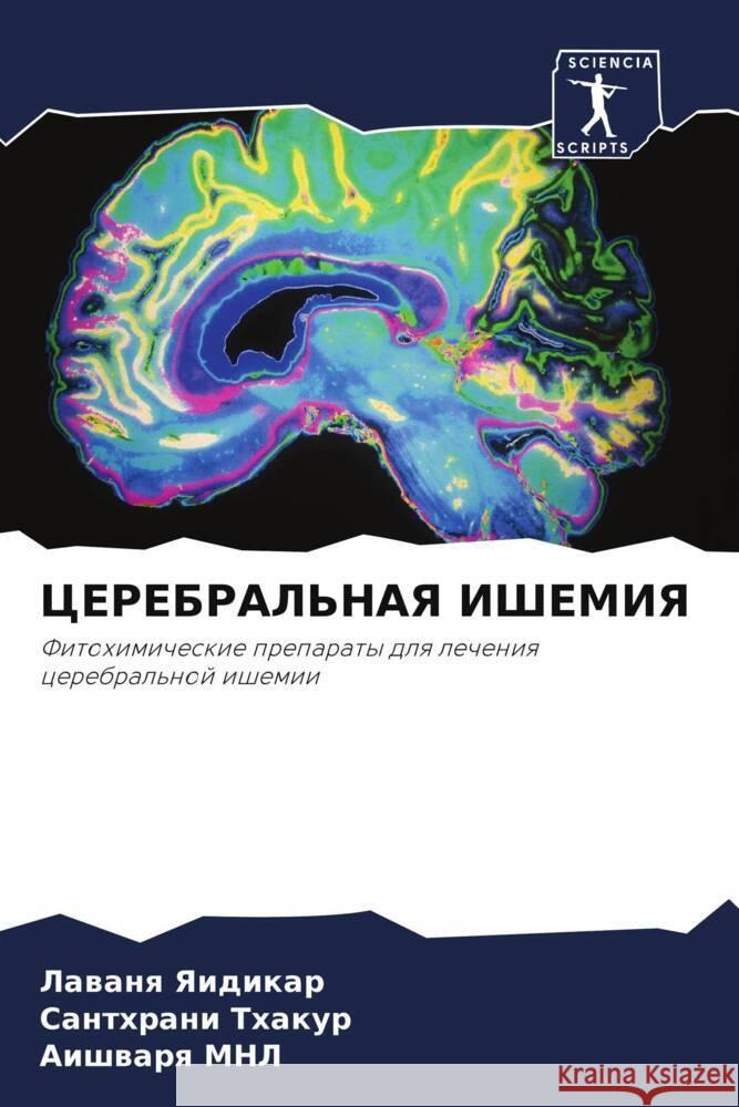 CEREBRAL'NAYa IShEMIYa Yaidikar, Lawanq, Thakur, Santhrani, MNL, Aishwarq 9786205563069 Sciencia Scripts - książka