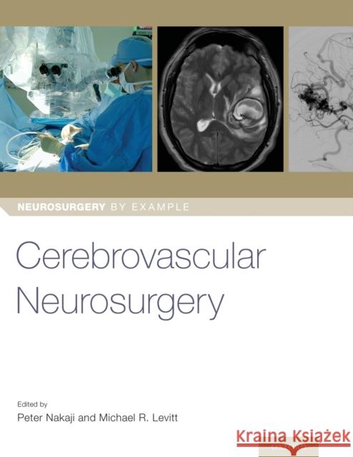 Cerebrovascular Neurosurgery Peter Nakaji Michael Levitt 9780190887728 Oxford University Press, USA - książka