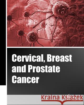 Cervical, Breast and Prostate Cancer (Classical Cover, Black and White) Iconcept Press 9781922227874 Iconcept Press - książka