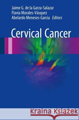 Cervical Cancer Jaime G. D Flavia Morales-Vazquez Abelardo Meneses-Garcia 9783319452302 Springer - książka