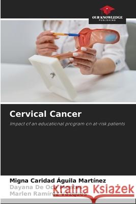 Cervical Cancer Águila Martínez, Migna Caridad, De Oca Montes, Dayana, Ramírez Vázques, Marlen 9786208983536 Our Knowledge Publishing - książka