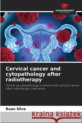 Cervical cancer and cytopathology after radiotherapy Ruan Silva 9786207740949 Our Knowledge Publishing - książka