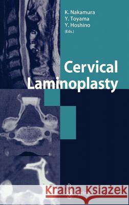 Cervical Laminoplasty Nakamura                                 Kozo Nakamura Yoshiaki Toyama 9784431703044 Springer - książka