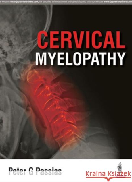 Cervical Myelopathy Peter Passias 9789351524922 Jaypee Brothers, Medical Publishers Pvt. Ltd. - książka