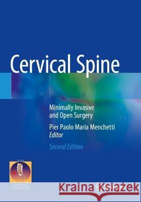 Cervical Spine  9783030948313 Springer International Publishing - książka