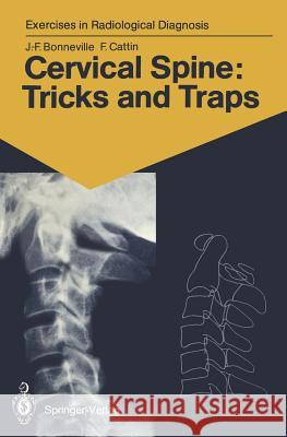 Cervical Spine: Tricks and Traps: 60 Radiological Exercises for Students and Practitioners Jean-Francois Bonneville, Francoise Cattin, Michel Gaudron 9783540176831 Springer-Verlag Berlin and Heidelberg GmbH &  - książka