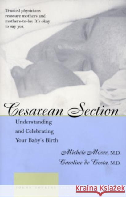 Cesarean Section: Understanding and Celebrating Your Baby's Birth Moore, Michele C. 9780801873379 Johns Hopkins University Press - książka