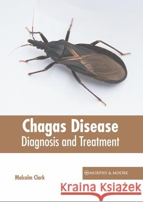 Chagas Disease: Diagnosis and Treatment Malcolm Clark 9781639871001 Murphy & Moore Publishing - książka