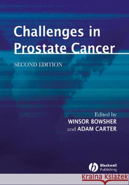 Challenges in Prostate Cancer Winsor Bowsher Adam Carter 9781405107525 Blackwell Publishing Professional - książka