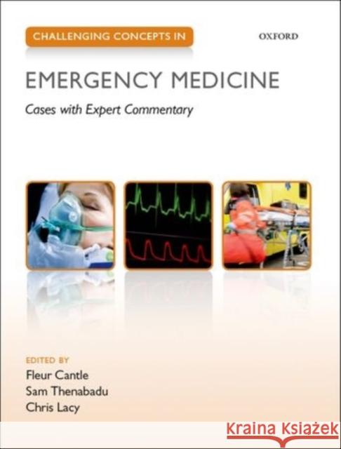 Challenging Concepts in Emergency Medicine: Cases with Expert Commentary Cantle, Fleur 9780199654093 OXFORD UNIVERSITY PRESS ACADEM - książka