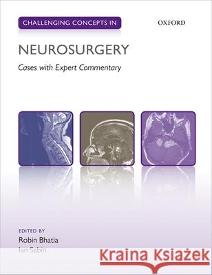 Challenging Concepts in Neurosurgery: Cases with Expert Commentary Robin Bhatia 9780199656400 OXFORD UNIVERSITY PRESS ACADEM - książka
