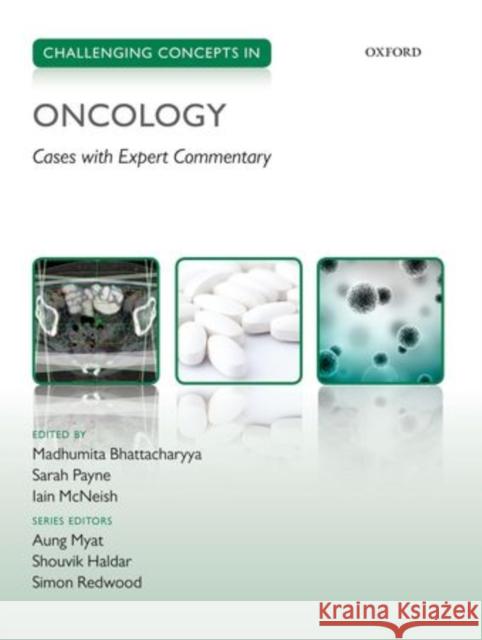 Challenging Concepts in Oncology: Cases with Expert Commentary Madhumita Bhattacharyya 9780199688883 OXFORD UNIVERSITY PRESS ACADEM - książka