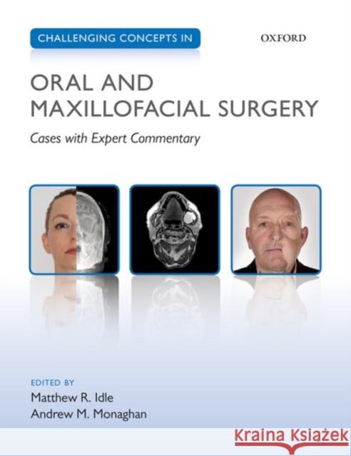Challenging Concepts in Oral and Maxillofacial Surgery: Cases with Expert Commentary Matthew Idle 9780199653553 OXFORD UNIVERSITY PRESS ACADEM - książka
