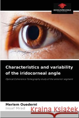 Characteristics and variability of the iridocorneal angle Meriem Ouederni Insaf Mrad 9786204044378 Our Knowledge Publishing - książka