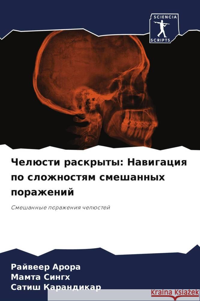 Chelüsti raskryty: Nawigaciq po slozhnostqm smeshannyh porazhenij Arora, Rajweer, Singh, Mamta, Karandikar, Satish 9786208152192 Sciencia Scripts - książka