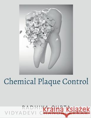 Chemical Plaque Control Radhika Gupta   9781648995460 Notion Press - książka