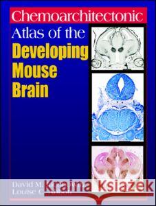 Chemoarchitectonic Atlas of the Developing Mouse Brain David M. Jacobowitz Louise C. Abbott 9780849326677 CRC Press - książka