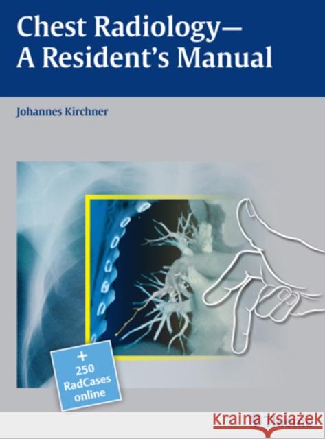 Chest Radiology: A Resident's Manual [With Access Code] Kirchner, Johannes 9783131538710 Thieme, Stuttgart - książka