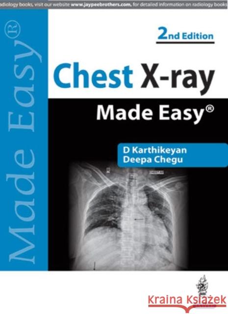 Chest X-Ray Made Easy D. Karthikeyan 9789350255636 Jp Medical Ltd - książka