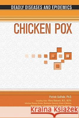 Chicken Pox Patrick Guilfoile 9781604132274 Chelsea House Publications - książka
