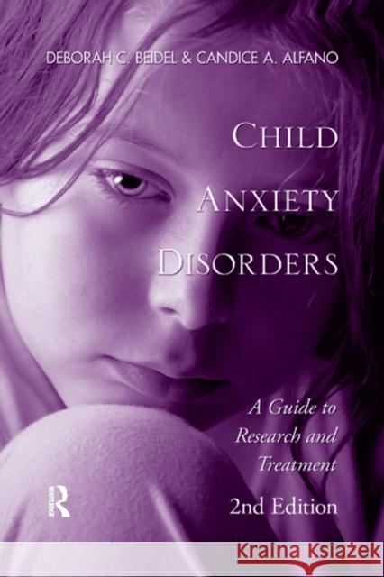 Child Anxiety Disorders: A Guide to Research and Treatment, 2nd Edition Beidel, Deborah C. 9781138377974 Taylor and Francis - książka