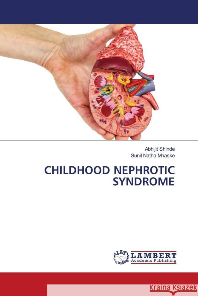 CHILDHOOD NEPHROTIC SYNDROME SHINDE, ABHIJIT, MHASKE, SUNIL NATHA 9786203870169 LAP Lambert Academic Publishing - książka