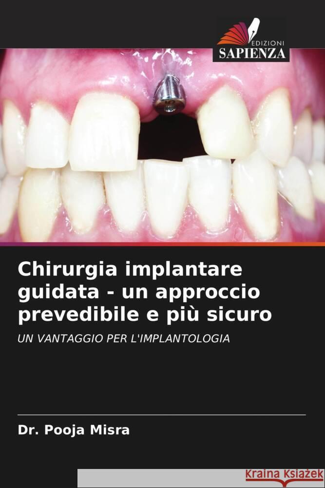 Chirurgia implantare guidata - un approccio prevedibile e più sicuro Misra, Dr. Pooja 9786205164785 Edizioni Sapienza - książka