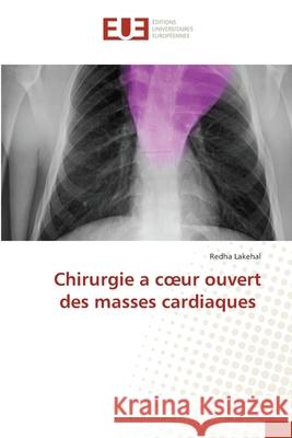 Chirurgie a coeur ouvert des masses cardiaques Lakehal, Redha 9786209115325 Éditions universitaires européennes - książka