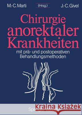 Chirurgie Anorektaler Krankheiten: Mit Prä- Und Postoperativen Behandlungsmethoden Nicholls, J. 9783642772344 Springer - książka