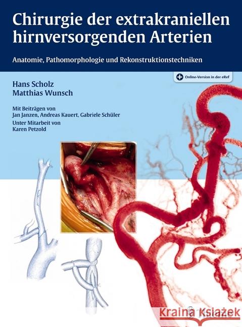 Chirurgie der extrakraniellen hirnversorgenden Arterien : Anatomie, Pathomorphologie und Rekonstruktionstechniken. Plus Online-Version in der eRef Scholz, Hans; Wunsch, Matthias 9783131772619 Thieme, Stuttgart - książka