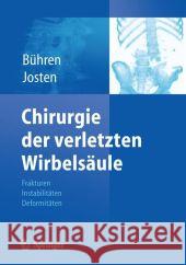 Chirurgie Der Verletzten Wirbelsäule: Frakturen, Instabilitäten, Deformitäten Bühren, Volker 9783642022074 Springer - książka