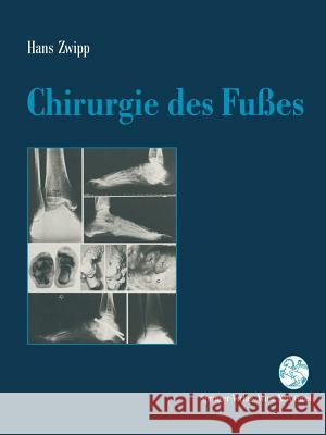 Chirurgie Des Fußes Zwipp, Hans 9783709173664 Springer - książka