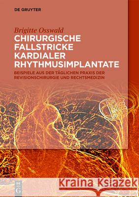 Chirurgische Fallstricke kardialer Rhythmusimplantate Osswald, Brigitte 9783110636963 de Gruyter - książka