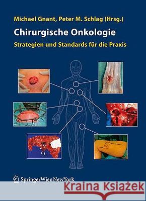 Chirurgische Onkologie: Strategien Und Standards Für Die Praxis Gnant, Michael 9783211486122 Springer, Wien - książka