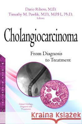 Cholangiocarcinoma: From Diagnosis to Treatment Dario Ribero, Timothy M Pawlik 9781634834889 Nova Science Publishers Inc - książka