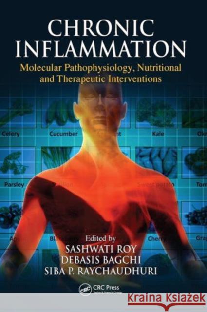 Chronic Inflammation: Molecular Pathophysiology, Nutritional and Therapeutic Interventions Roy, Sashwati 9781439872116 CRC Press - książka