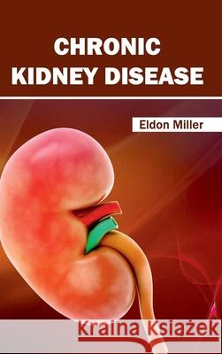 Chronic Kidney Disease Eldon Miller 9781632420770 Foster Academics - książka