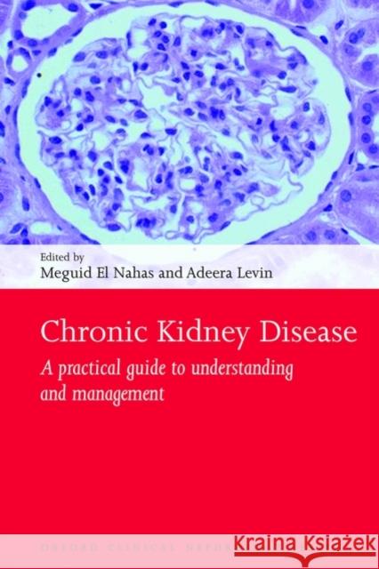 Chronic Kidney Disease: A Practical Guide to Understanding and Management El Nahas, Meguid 9780199549313  - książka