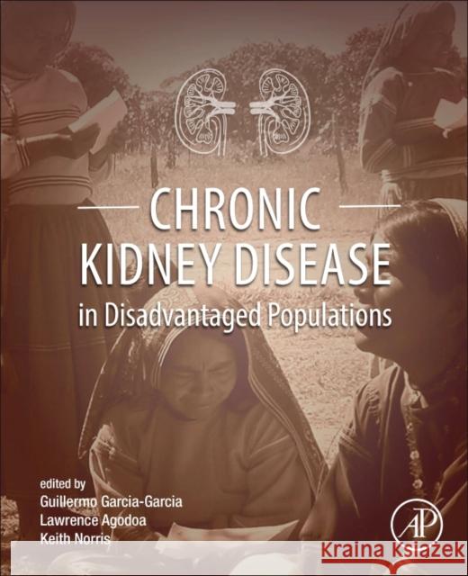Chronic Kidney Disease in Disadvantaged Populations Guillermo Garcia-Garcia Lawrence Agodoa Keith C. Norris 9780128043110 Academic Press - książka