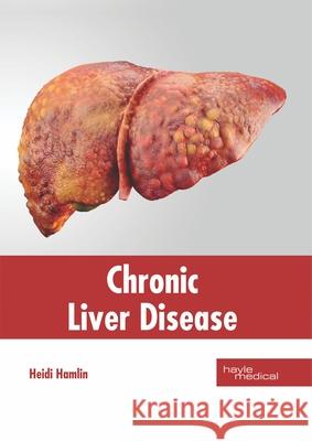 Chronic Liver Disease Heidi Hamlin 9781632416353 Hayle Medical - książka