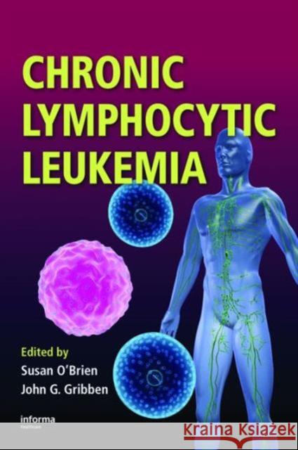 Chronic Lymphocytic Leukemia Susan O'Brien John G. Gribben 9781420068955 Informa Healthcare - książka