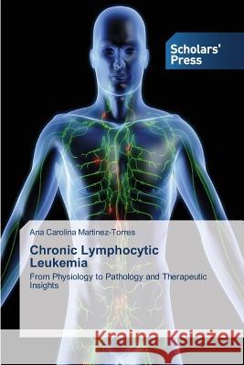 Chronic Lymphocytic Leukemia Martinez-Torres Ana Carolina 9783639707847 Scholars' Press - książka