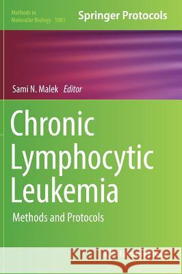 Chronic Lymphocytic Leukemia: Methods and Protocols Malek, Sami N. 9781493988754 Humana Press - książka