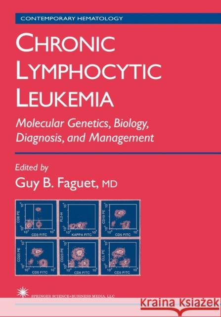 Chronic Lymphocytic Leukemia: Molecular Genetics, Biology, Diagnosis, and Management Faguet, Guy B. 9781617373558 Springer - książka