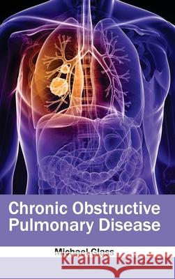 Chronic Obstructive Pulmonary Disease Michael Glass 9781632410849 Hayle Medical - książka