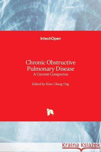 Chronic Obstructive Pulmonary Disease: A Current Conspectus Kian Chung Ong 9781839689260 Intechopen - książka