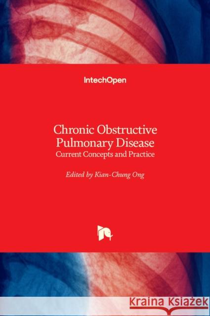 Chronic Obstructive Pulmonary Disease: Current Concepts and Practice Kian Chung Ong 9789535101635 Intechopen - książka