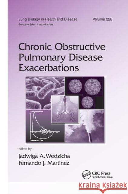 Chronic Obstructive Pulmonary Disease Exacerbations  9781138372450 Taylor and Francis - książka